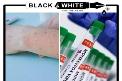 India on High Alert: Understanding Mpox Symptoms and Transmission Amid Rising Concerns