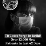 TB Concerns Rise In Delhi: 12,078 New Cases Detected In Just 42 Days