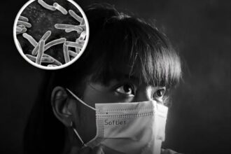TB Concerns Rise In Delhi: 12,078 New Cases Detected In Just 42 Days