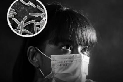 TB Concerns Rise In Delhi: 12,078 New Cases Detected In Just 42 Days